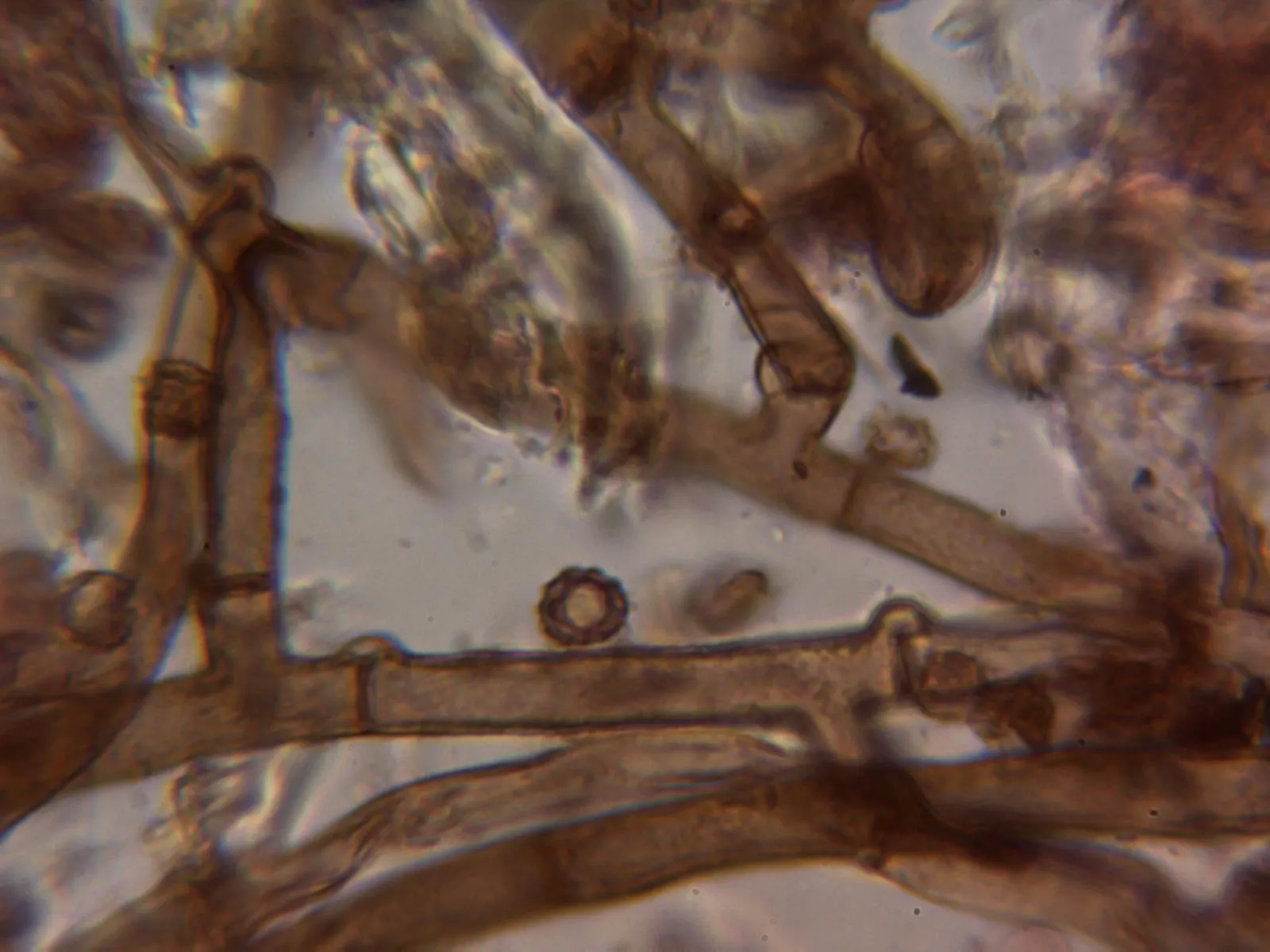Microscopía de Tomentella griseoviolacea - 10 - Hifas subiculares